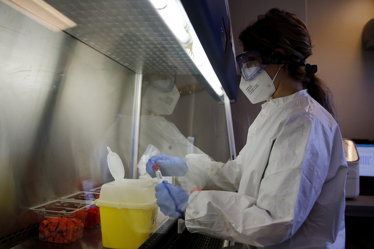 Labo Rani Znanstvenici pronašli biomarker koji otkriva rani stadij teškog oblika ...