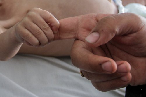 Six-month-old with chest infection in Gaza shows how children starve Gaza hospital