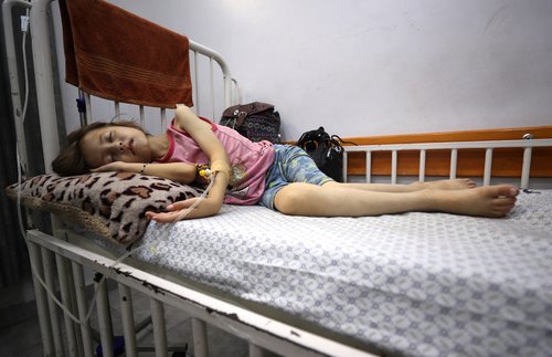 A Palestinian girl Jana Ayad, who is malnourished, according to medics, lies on a bed as she receives treatment at a hospital in Gaza City, amid a worsening hunger crisis, July 29, 2025. REUTERS/Mahmoud Issa
