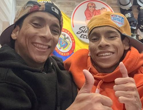 Sijamski blizanci iz Ecuadora Jose Luis i Jose Armando preminuli u 27. godini