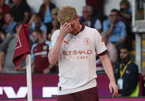 Premier League - Burnley v Manchester City