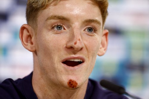 Euro 2024 - England Press Conference