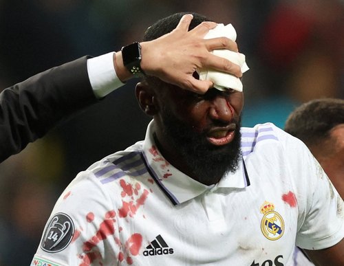Champions League - Group F - Shakhtar Donetsk v Real Madrid