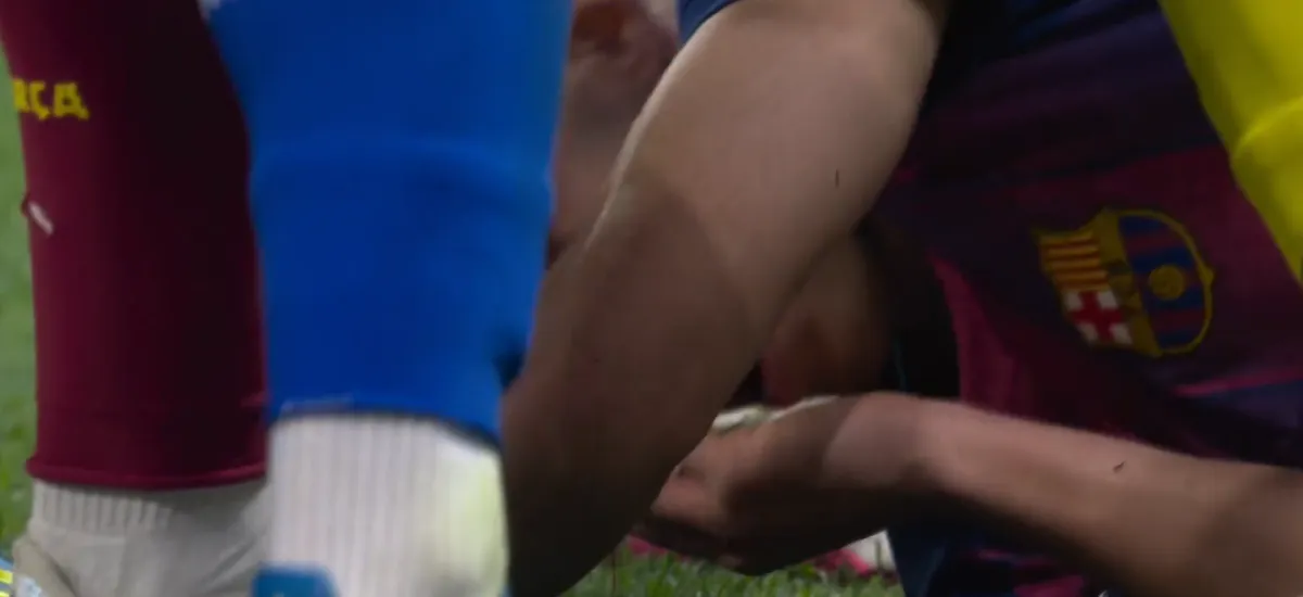 Jezive scene u Ligi šampiona, fudbaleru Barselone krvarila glava