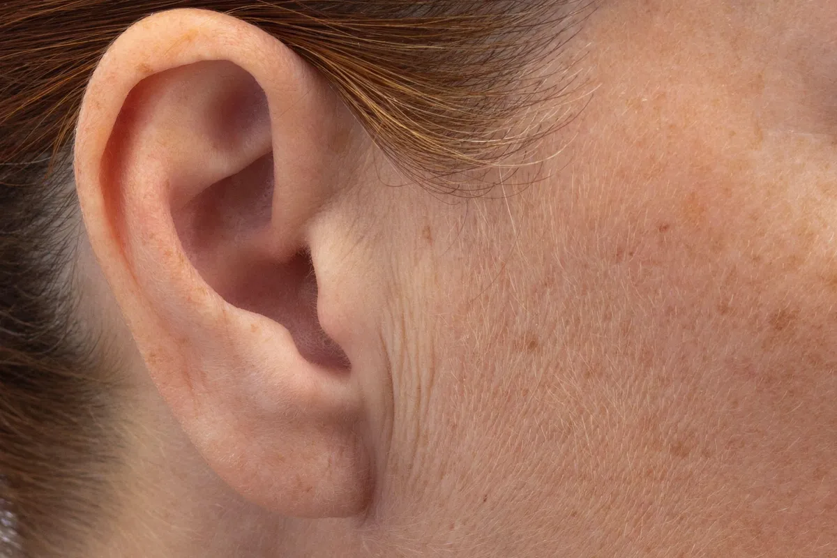 Nada za milione: Odobrena prva genska terapija u svijetu za liječenje gluhoće