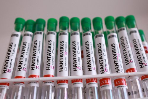 FILE PHOTO: Test tubes labelled "Hantavirus positive" in this illustration taken May 7, 2026. REUTERS/Dado Ruvic/Illustration/File Photo