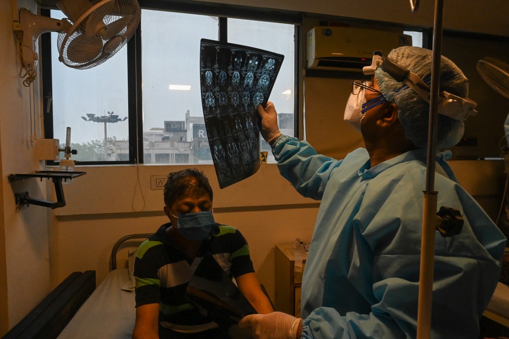 crna gljivica mukormikoza