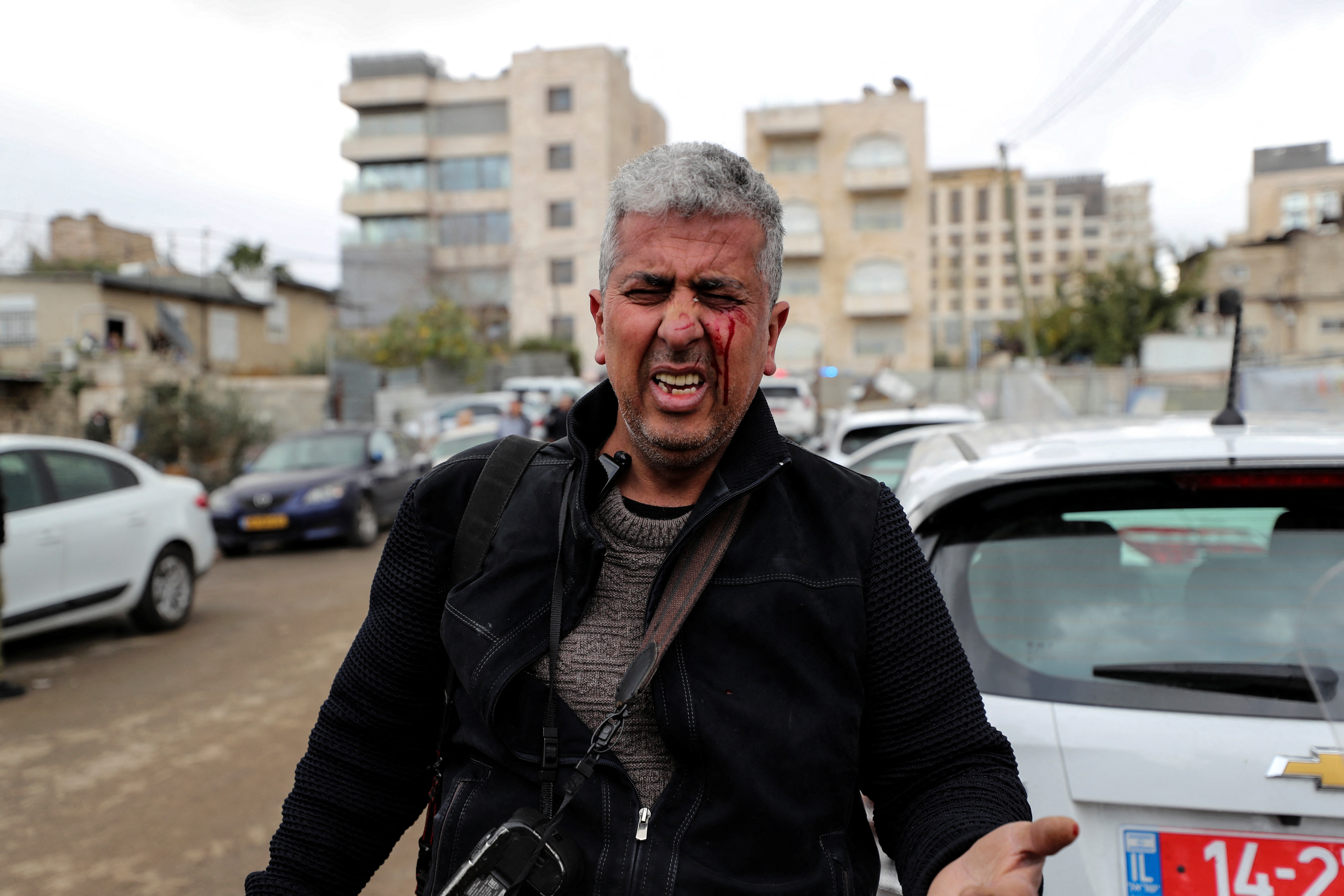 AP photographer Mahmoud Illean reacts after being injured by Israeli police during a protest in the East Jerusalem neighbourhood of Sheikh Jarrah