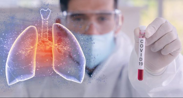 1643616830-1639389209-shutterstock_1645104367-e1639389347718-750x405