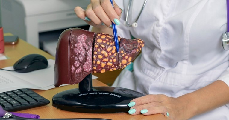 e90a770a-1945-4e06-bbdb-d970edd329e7