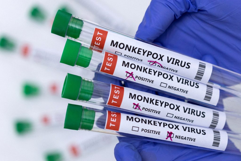 1654592821-2022-06-01T142141Z_784198030_RC21JU9X3YJB_RTRMADP_3_HEALTH-MONKEYPOX-PORTUGAL-1024x683