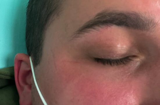 1666260482-student-kog-je-udario-policajac-sodros-550x360