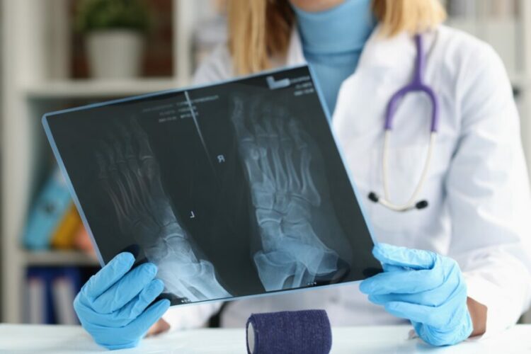 Doctor,Traumatologist,Examines,X-ray,Of,Feet.,Foot,Pain,Causes,And