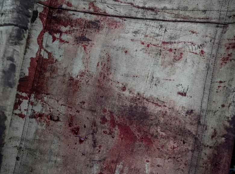 Krv na nosilima u blizini centra za medicinsku pomoć u Donjeckoj oblasti, Ukrajina, 22. novembra. Radio Slobodna Evropa/Radio Sloboda/Serhii Nuzhnenko, preuzeto sa Reutersa