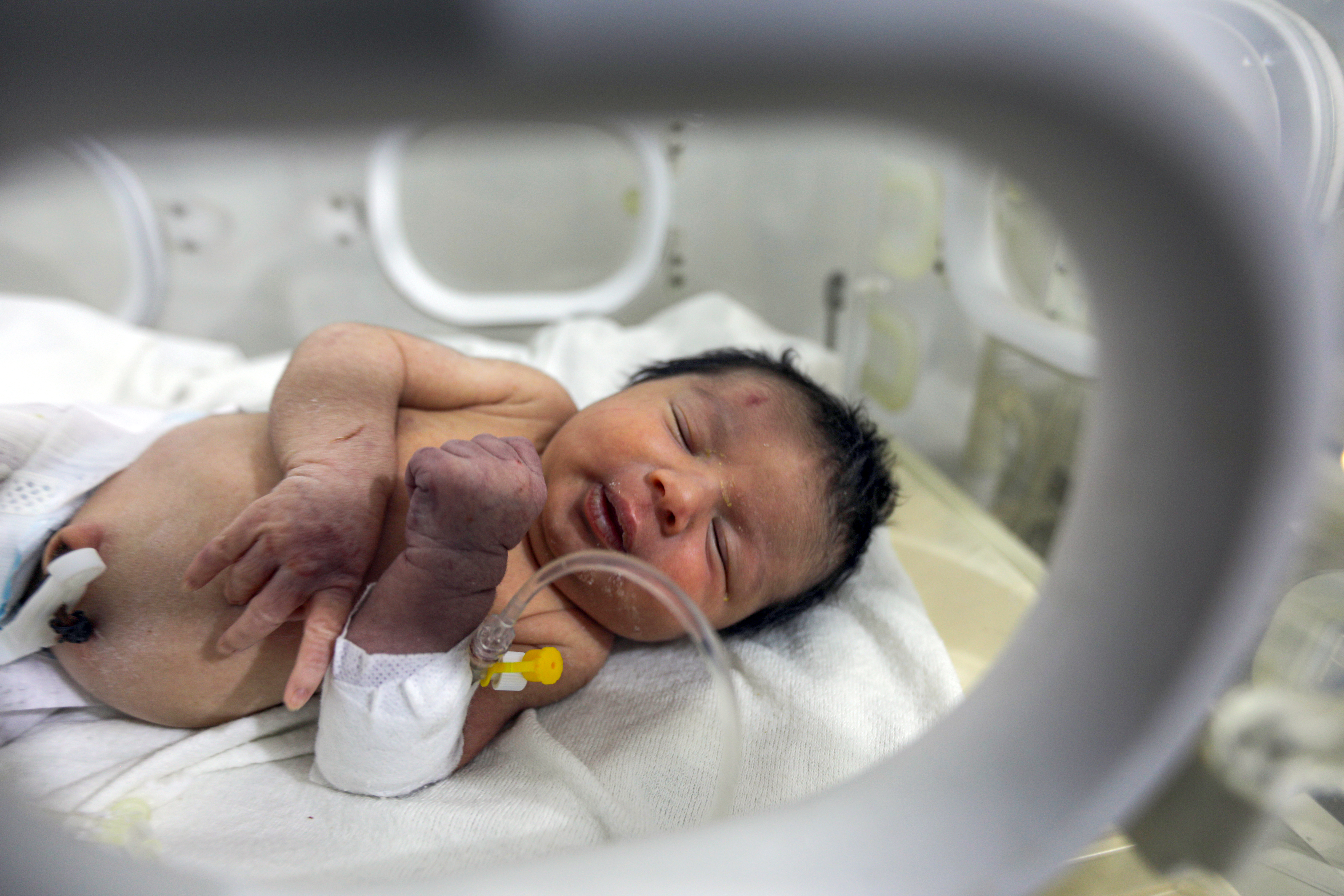 Sirija: Djevojčici rođenoj ispod ruševina stradala cijela porodica