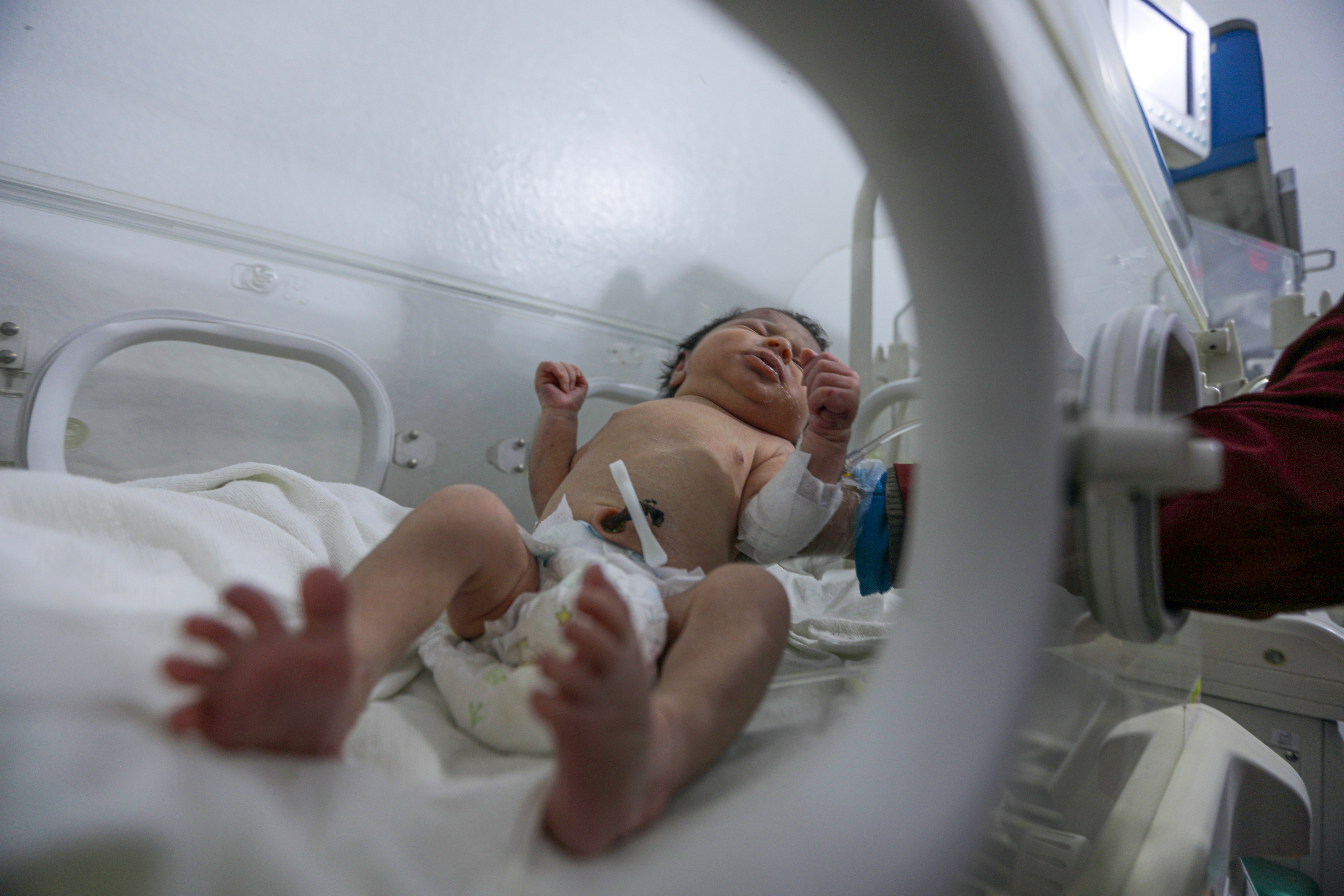 Sirija: Djevojčici rođenoj ispod ruševina stradala cijela porodica