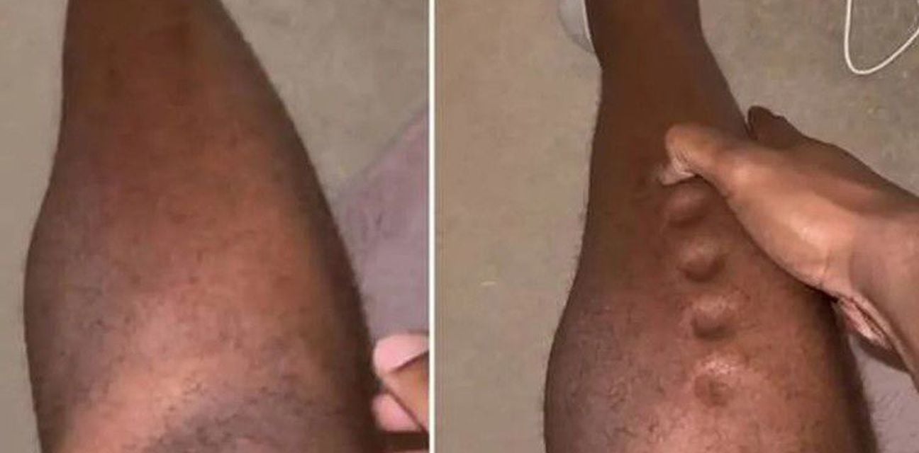 62481993-lawrence-okoye