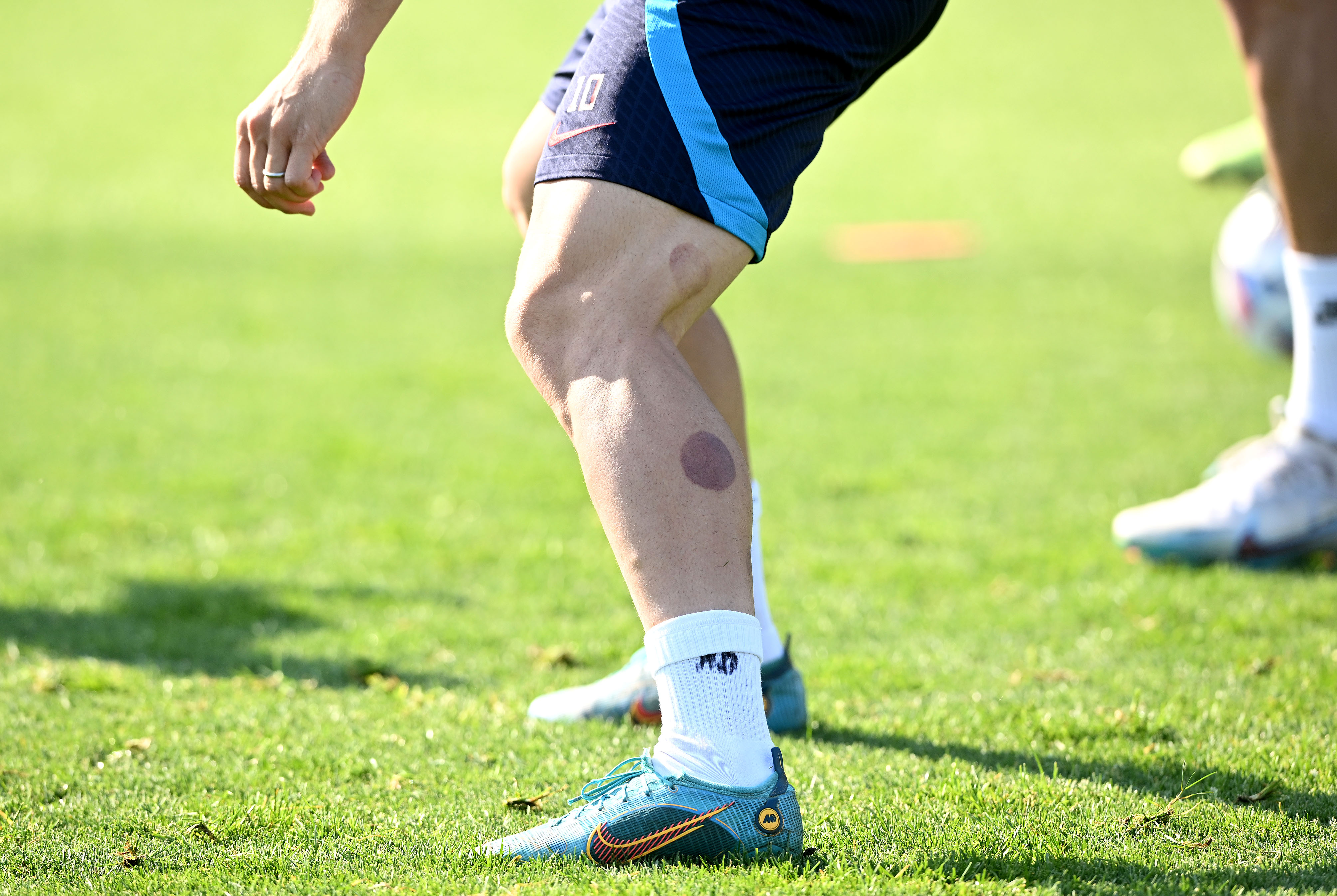 Rotterdam: Na Modrićevim nogama vidljivi tragovi cupping terapije