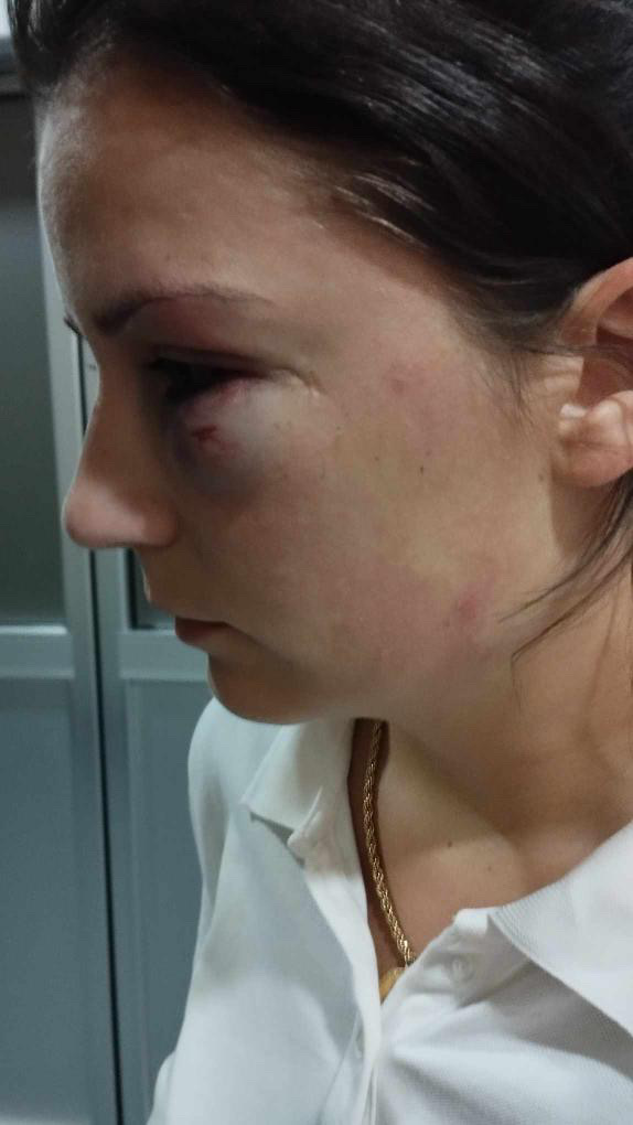 Ustupljena fotografija