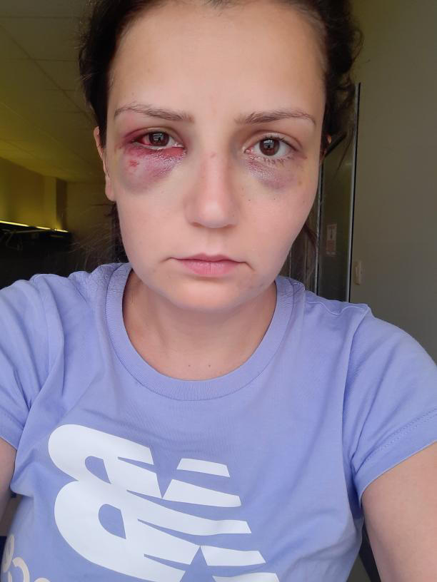 Ustupljena fotografija