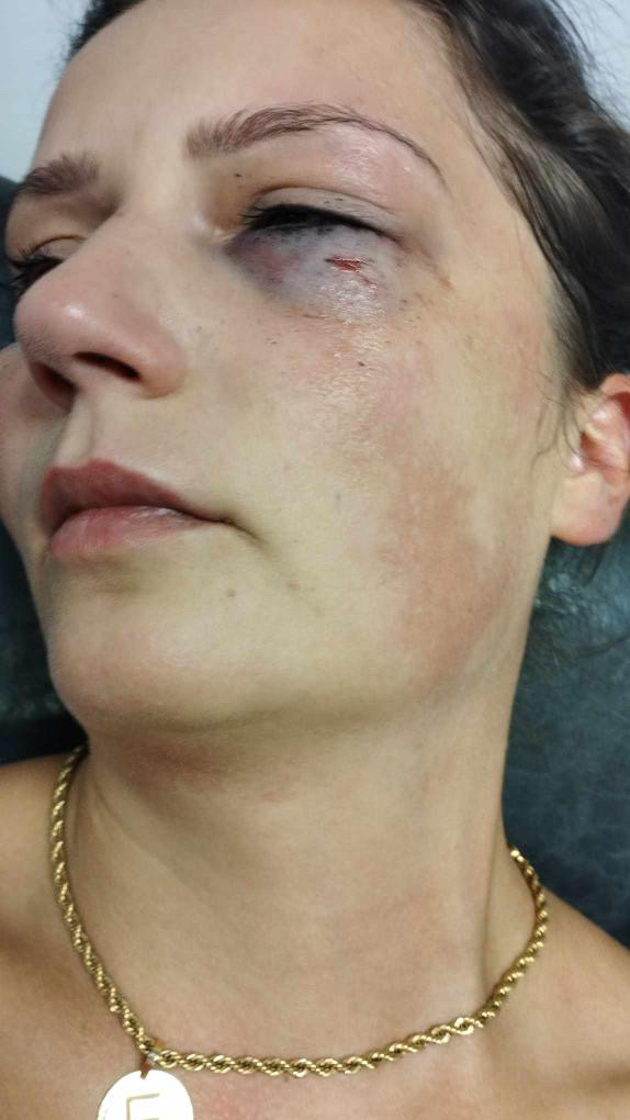 Enisa-klepo-1thumbnail_Image(1)