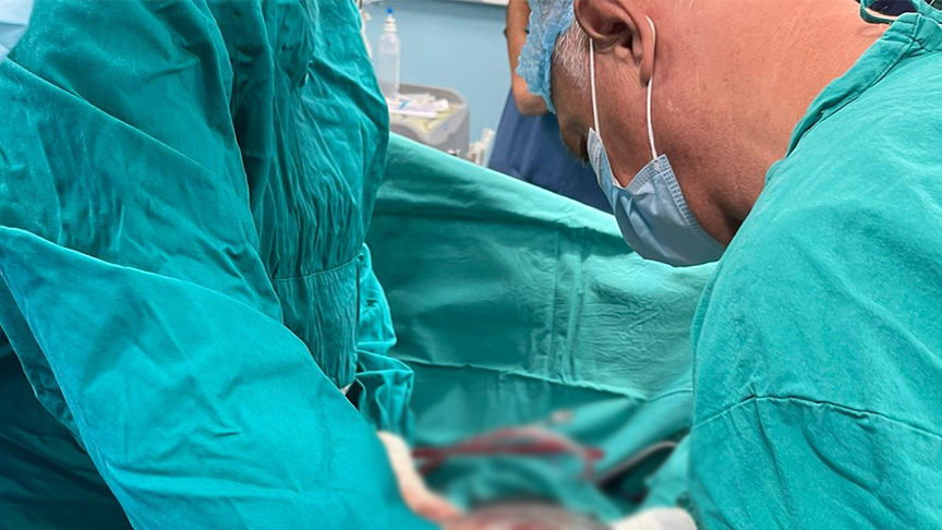 UKC RS-a: Uspješno odstranjen gigantski tumor težak 23 kilograma