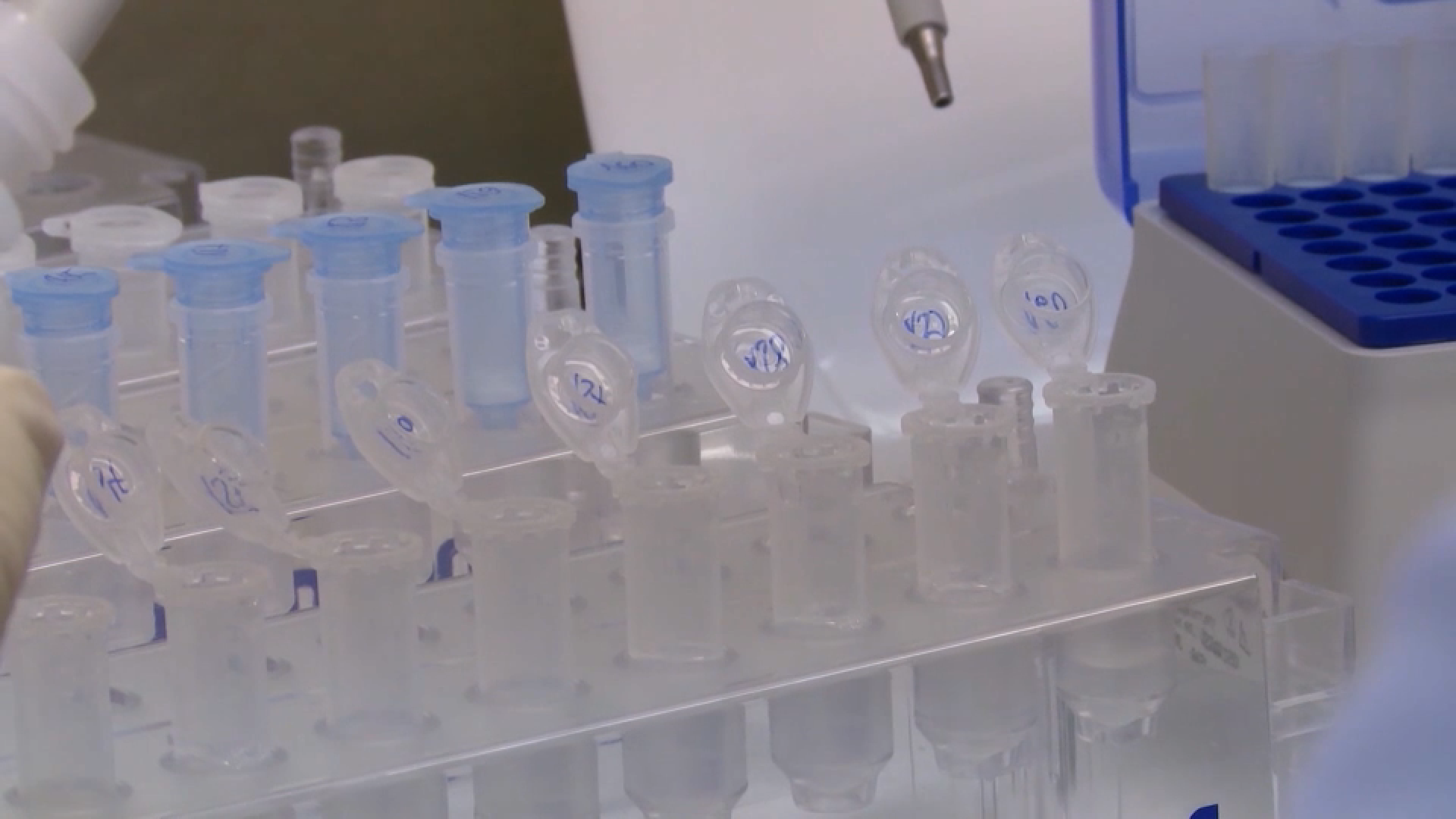 morbile laboratorija zarazne bolesti