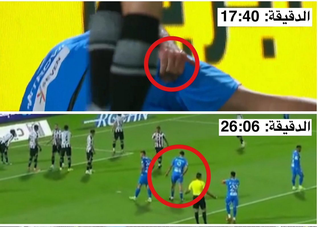 1711967368-Aleksandar-MItrovic-povreda