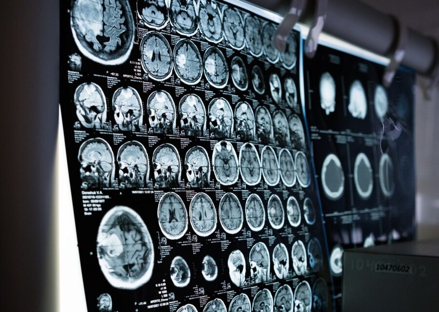 1706689852-ct-scan-7000111_1920-900x641