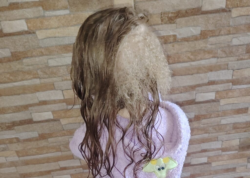 Djevojčici iz Leskovca rastu tri vrste kose