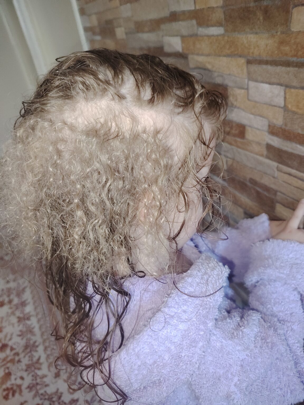 Djevojčici iz Leskovca rastu tri vrste kose