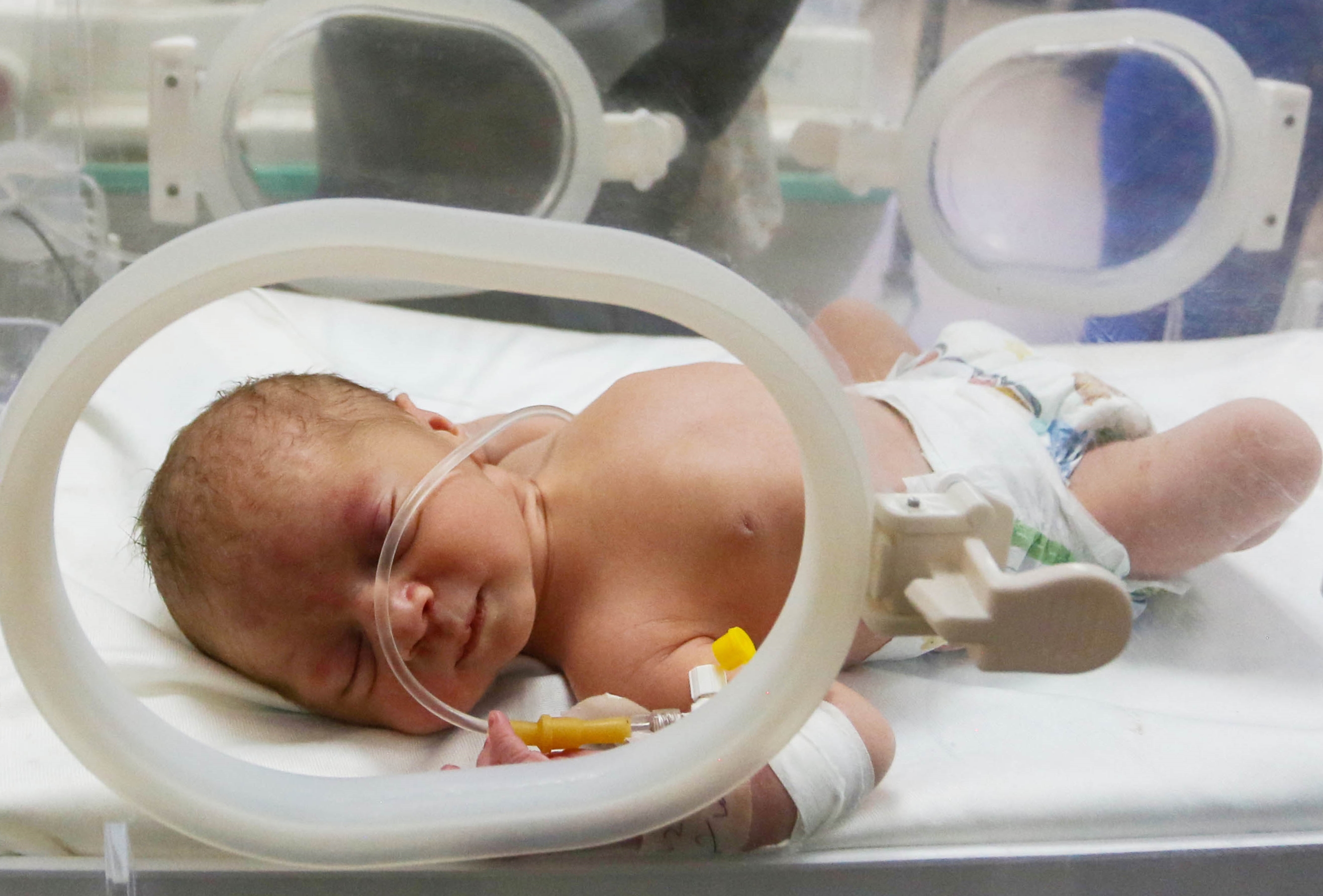 Beba u Gazi spašena iz stomaka majke ubijene u izraelskom napadu