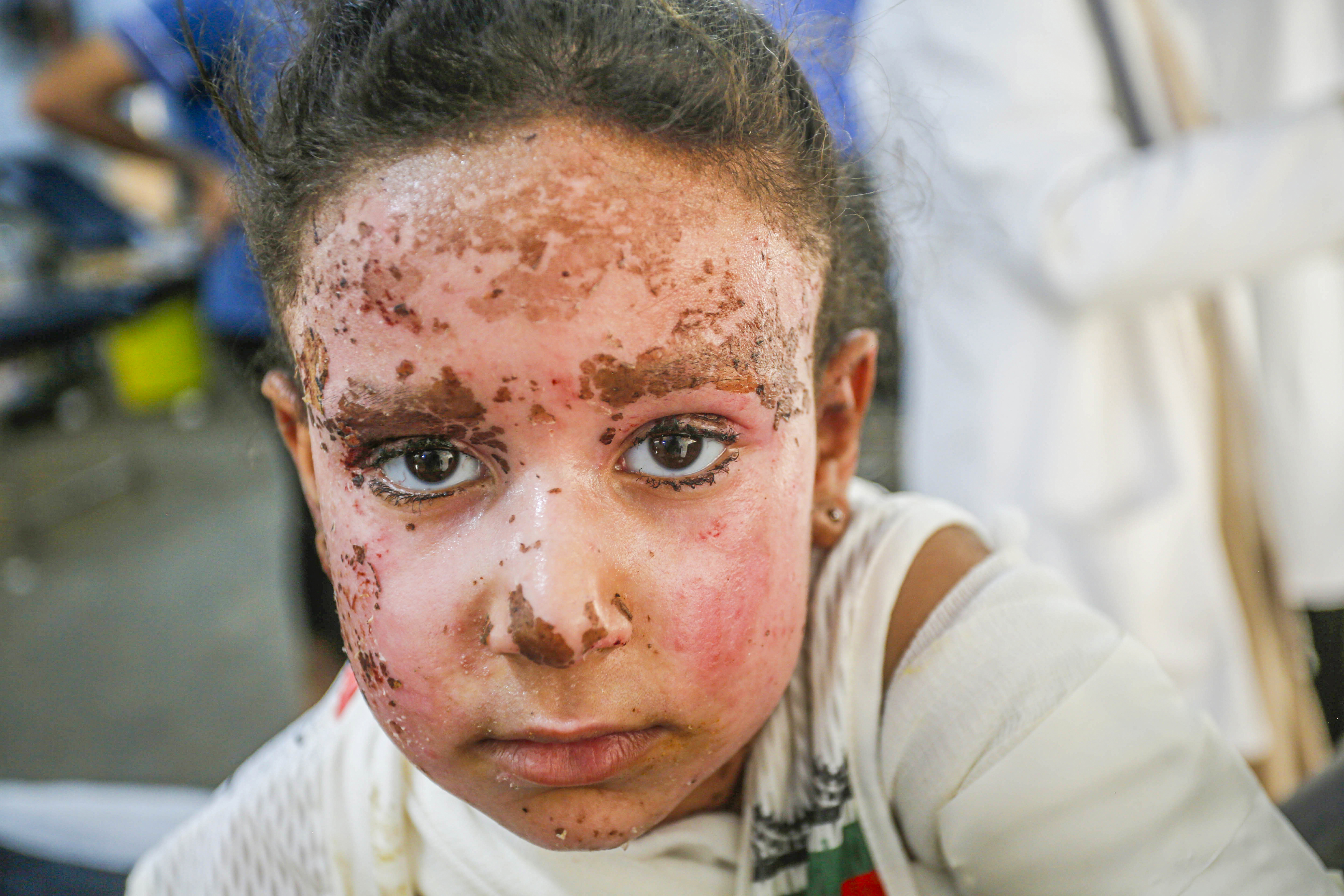 Djevojčica Yafa izgubila deset članova porodice u izraelskom napadu u Gazi: Nedostaju mi majka, braća i sestre