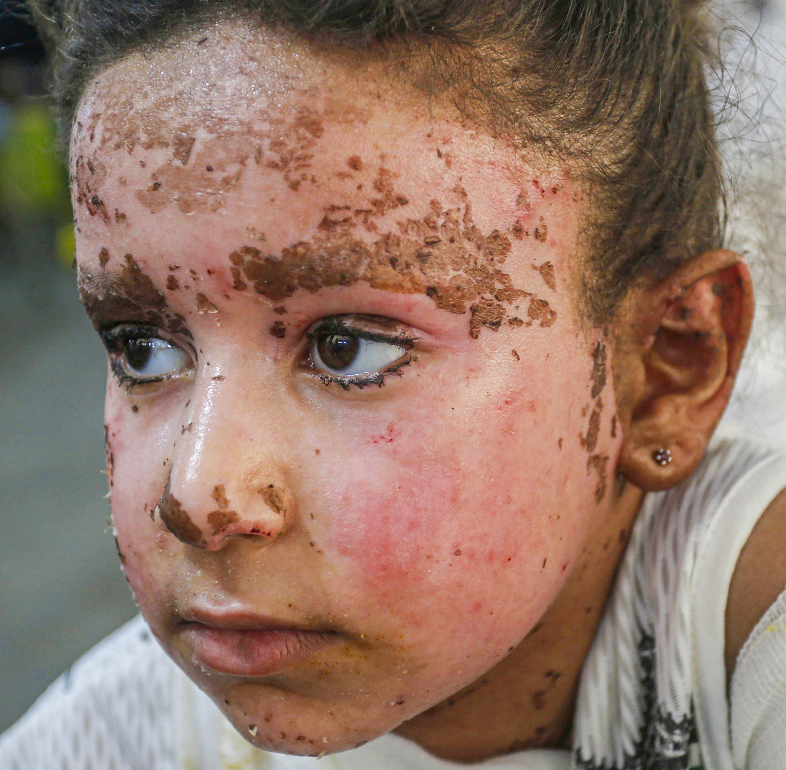 Djevojčica Yafa izgubila deset članova porodice u izraelskom napadu u Gazi: Nedostaju mi majka, braća i sestre