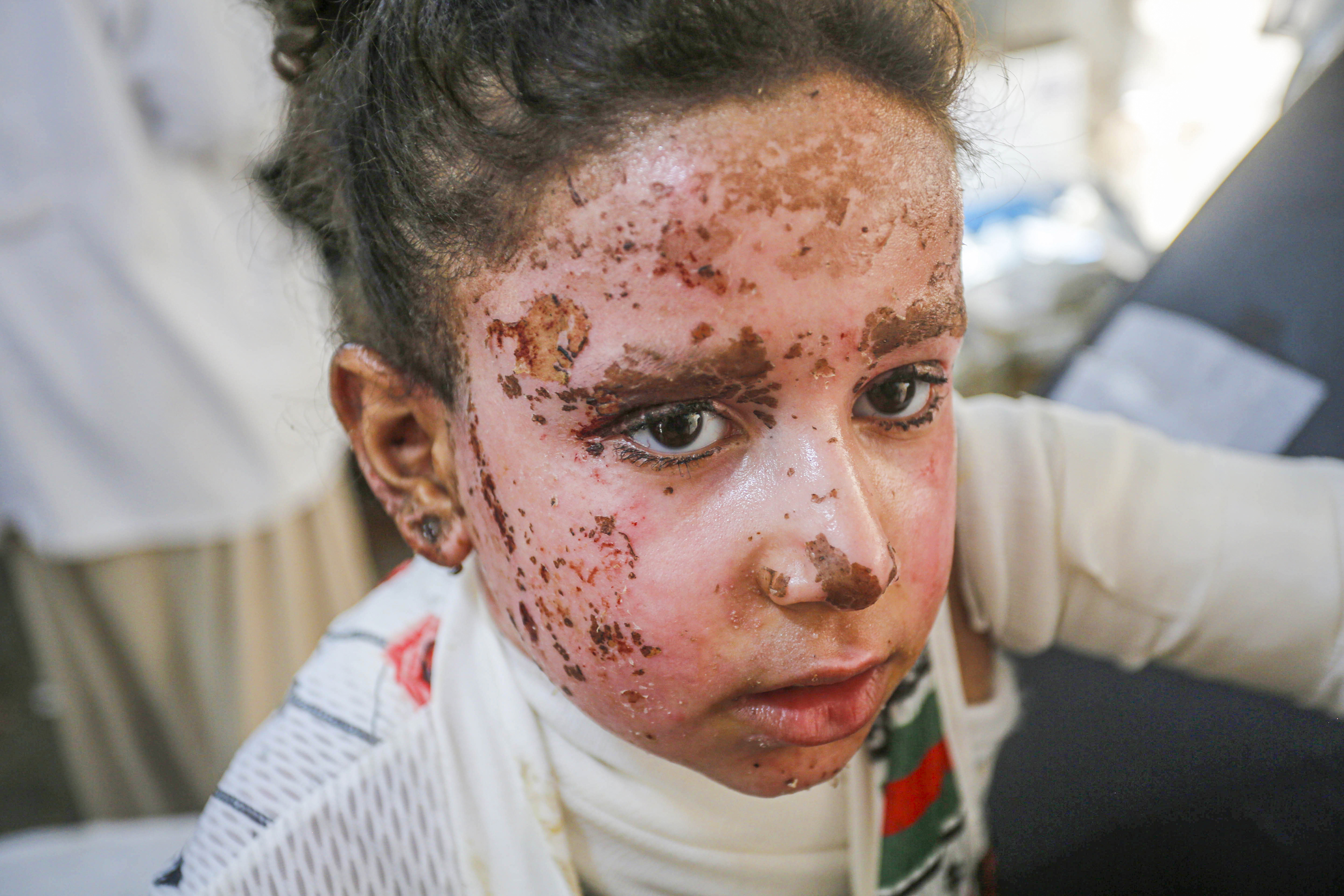 Djevojčica Yafa izgubila deset članova porodice u izraelskom napadu u Gazi: Nedostaju mi majka, braća i sestre