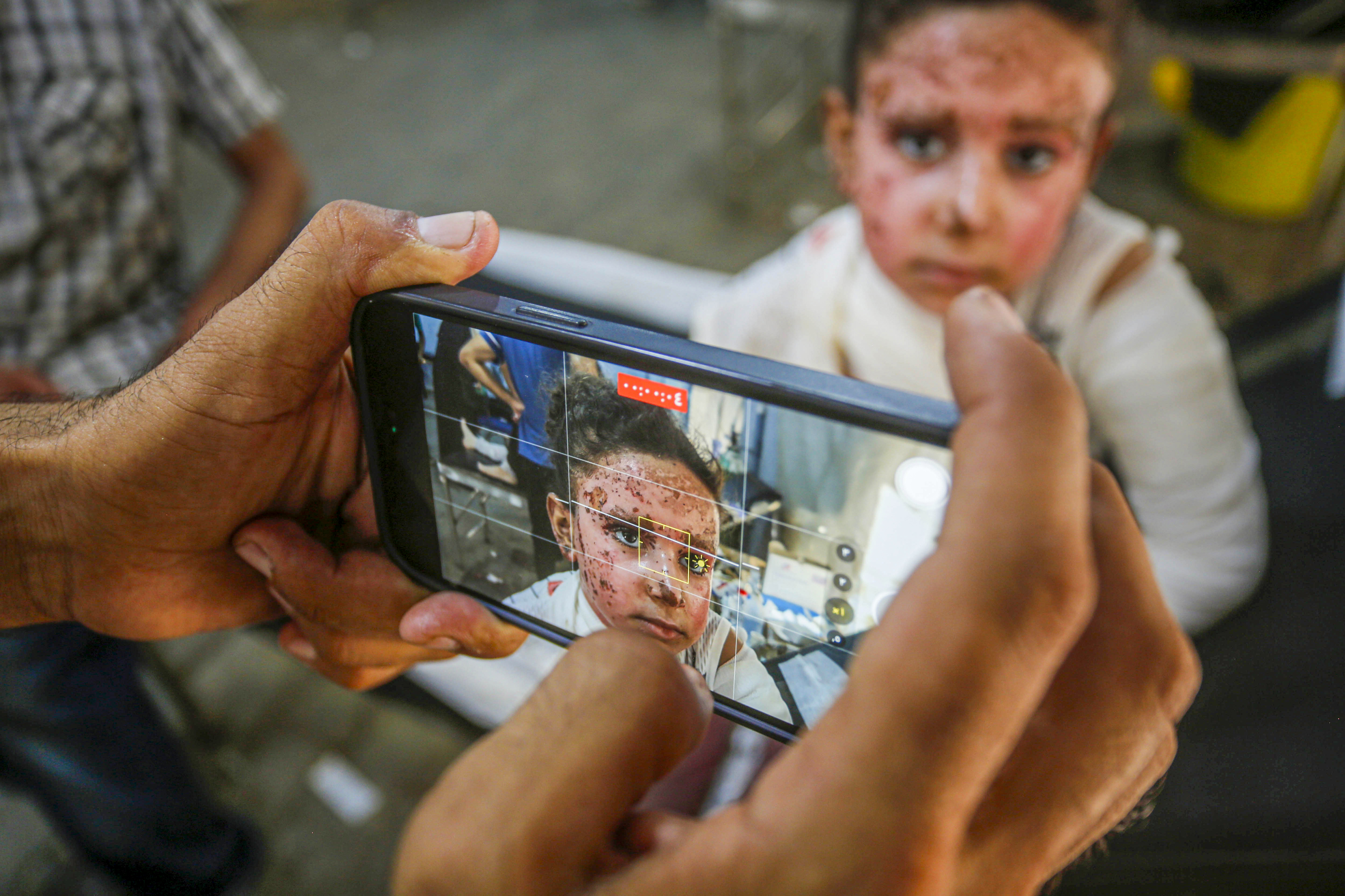 Djevojčica Yafa izgubila deset članova porodice u izraelskom napadu u Gazi: Nedostaju mi majka, braća i sestre