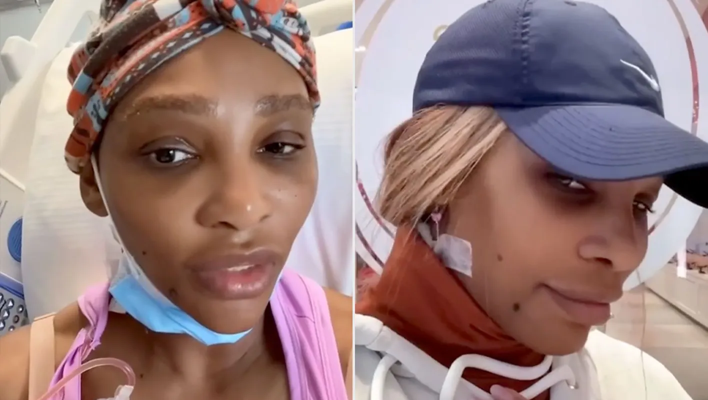 1729145496-serena-vilijams-operacija-cista-vrat