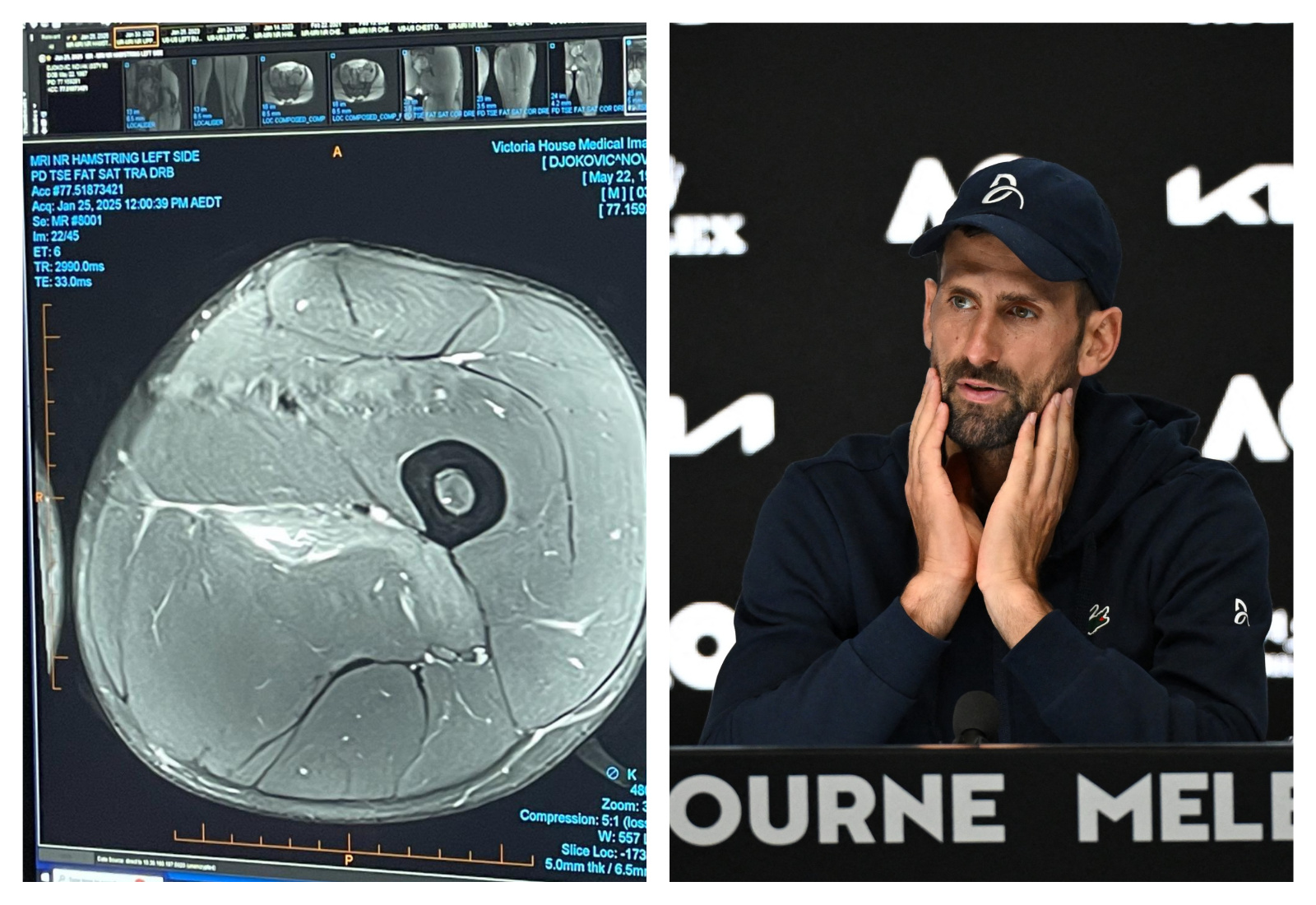 1737970256-MixCollage-27-Jan-2025-10-30-AM-7425