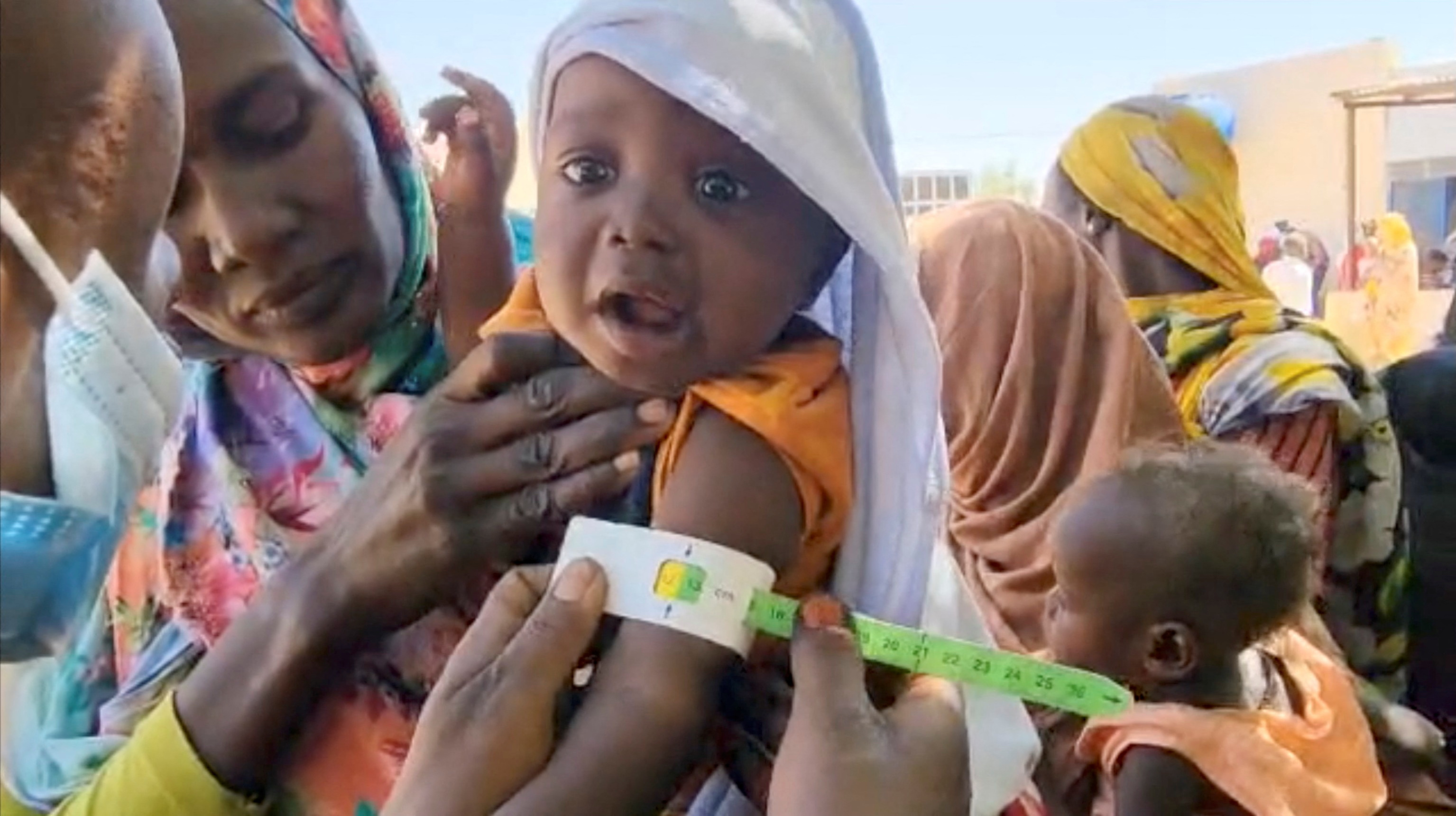 A child gets tested for malnutrition at World Food Program (WFP) camp at El Fasher, in Darfur
