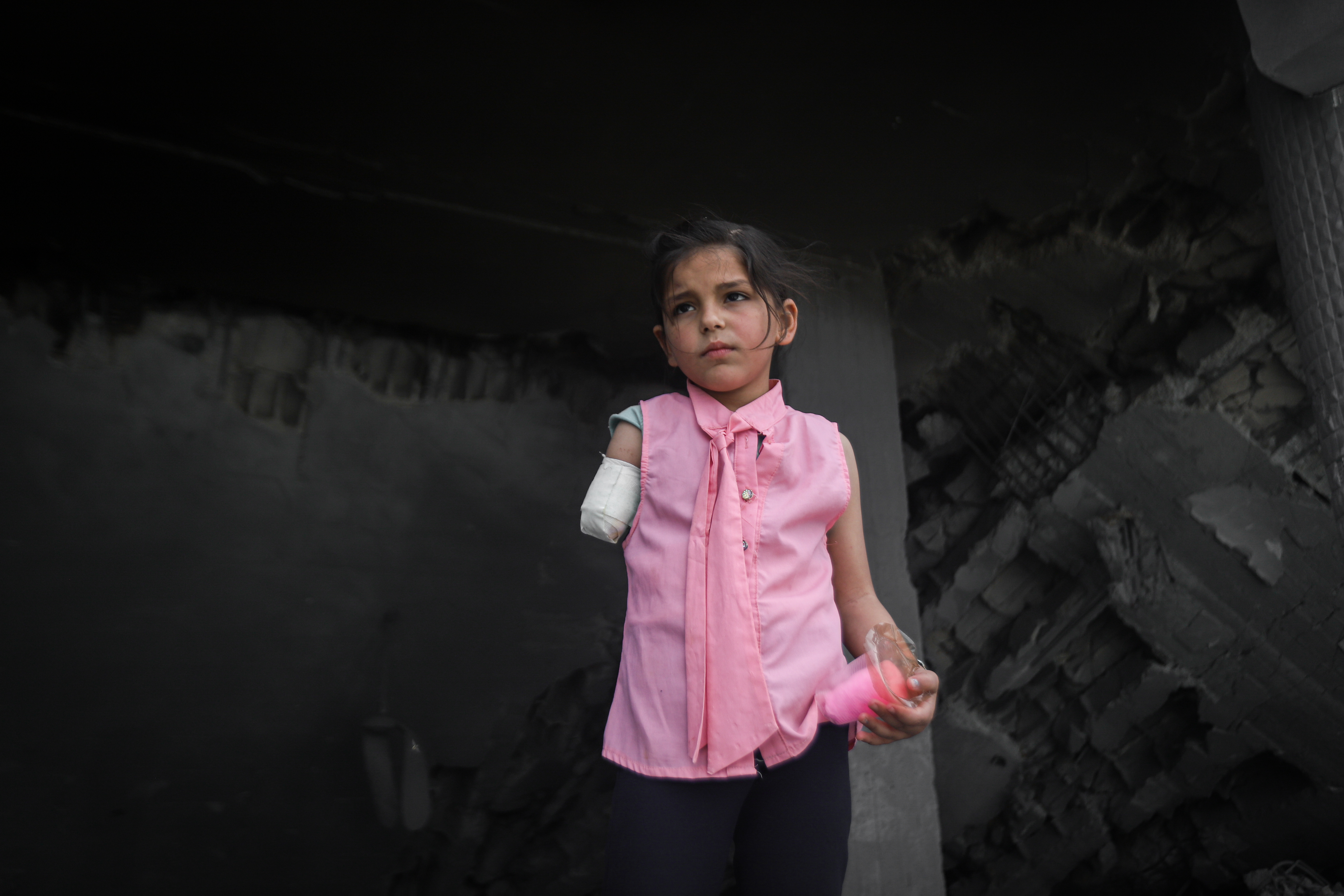 Djetinjstvo u Gazi: Gade Debabesh ostala bez ruke u izraelskom napadu na školu