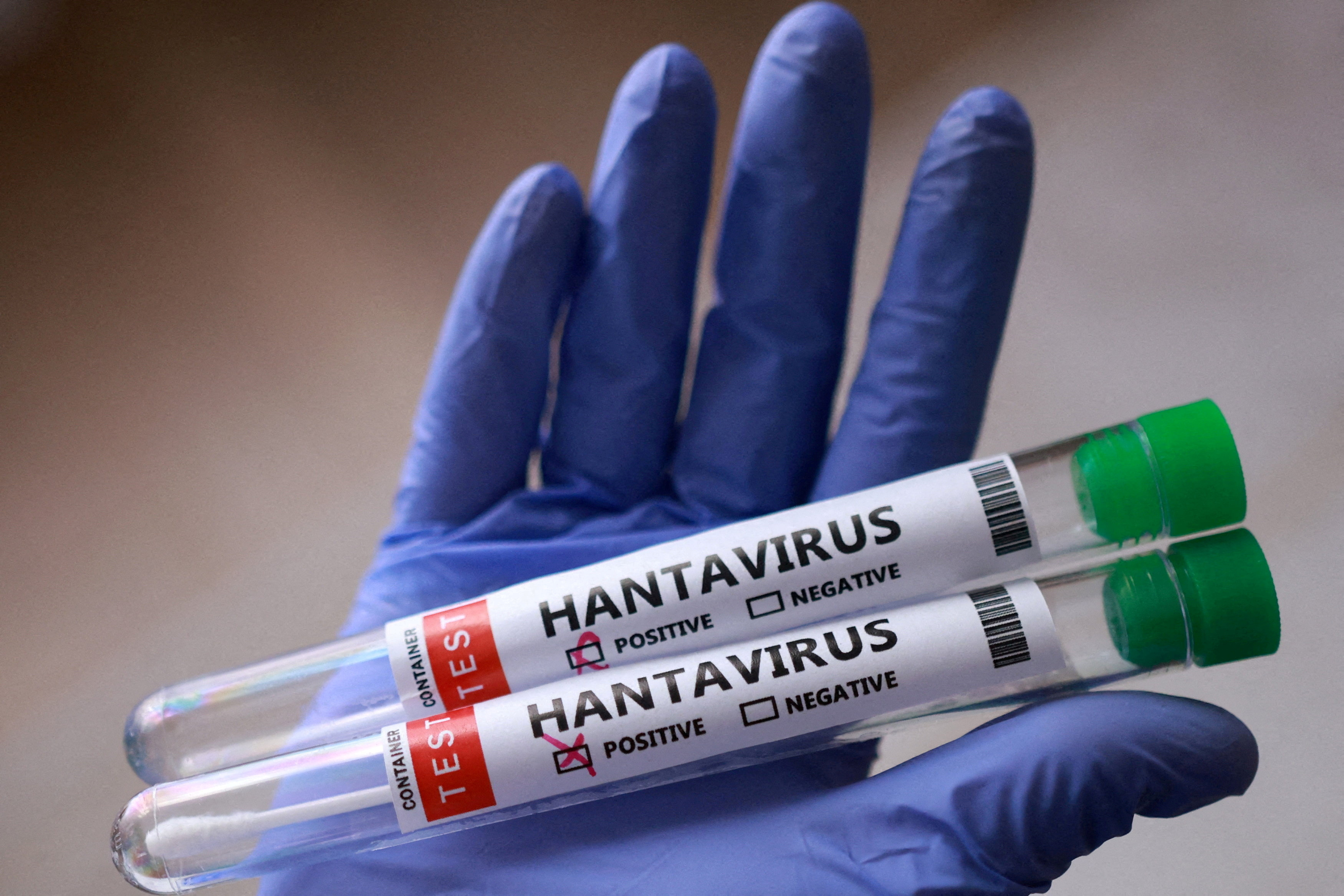 FILE PHOTO: Test tubes labelled "Hantavirus positive" are held in this illustration taken May 7, 2026. REUTERS/Dado Ruvic/Illustration/File Photo