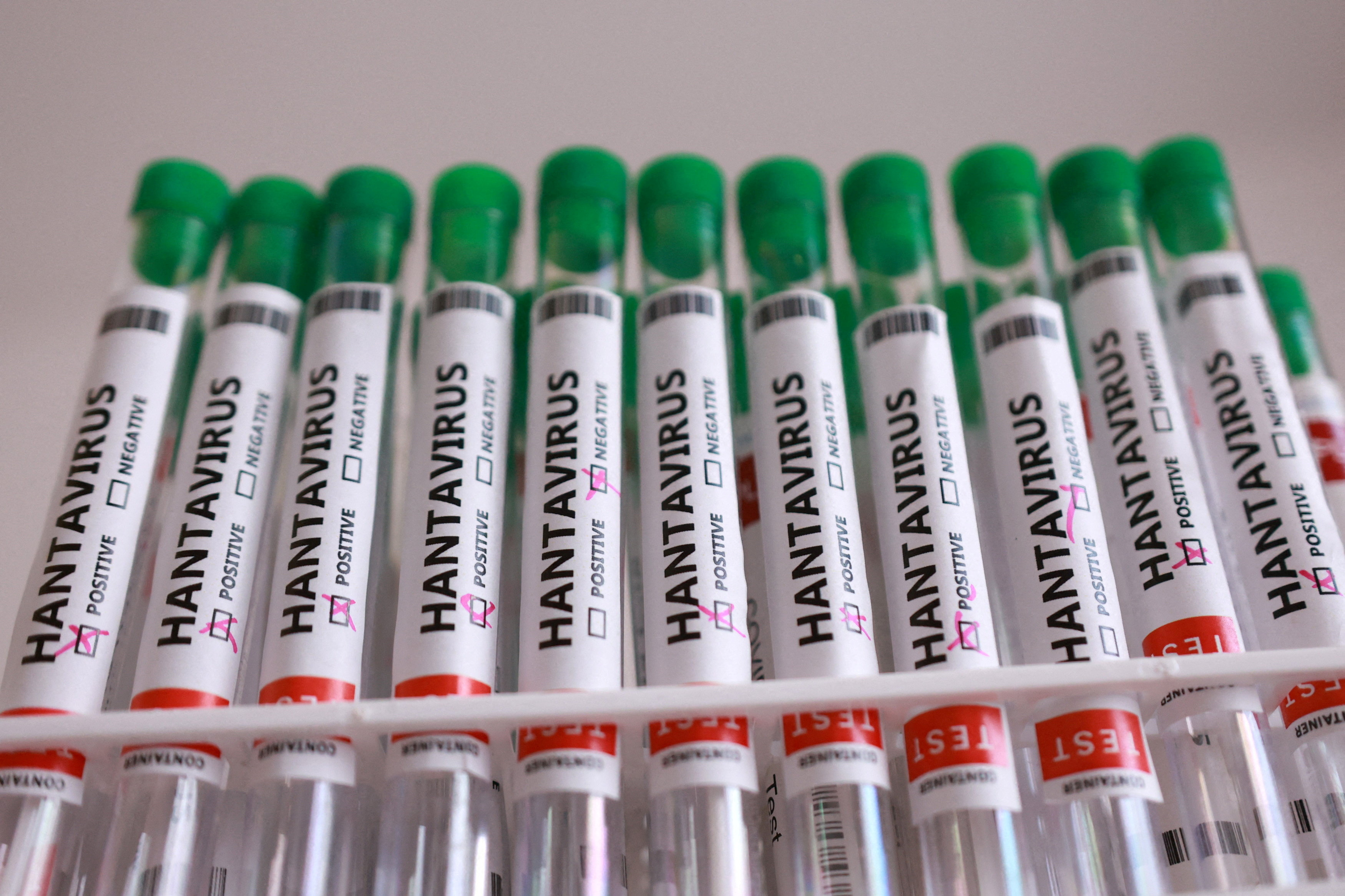 FILE PHOTO: Test tubes labelled "Hantavirus positive" in this illustration taken May 7, 2026. REUTERS/Dado Ruvic/Illustration/File Photo