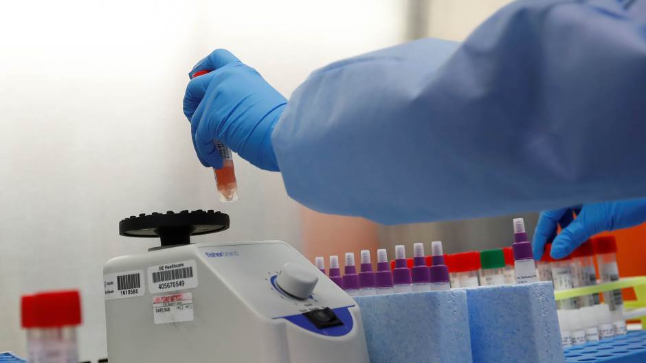 2020-03-11T191614Z_675547089_RC2VHF94YJB7_RTRMADP_3_HEALTH-CORONAVIRUS-NEW-YORK-LAB