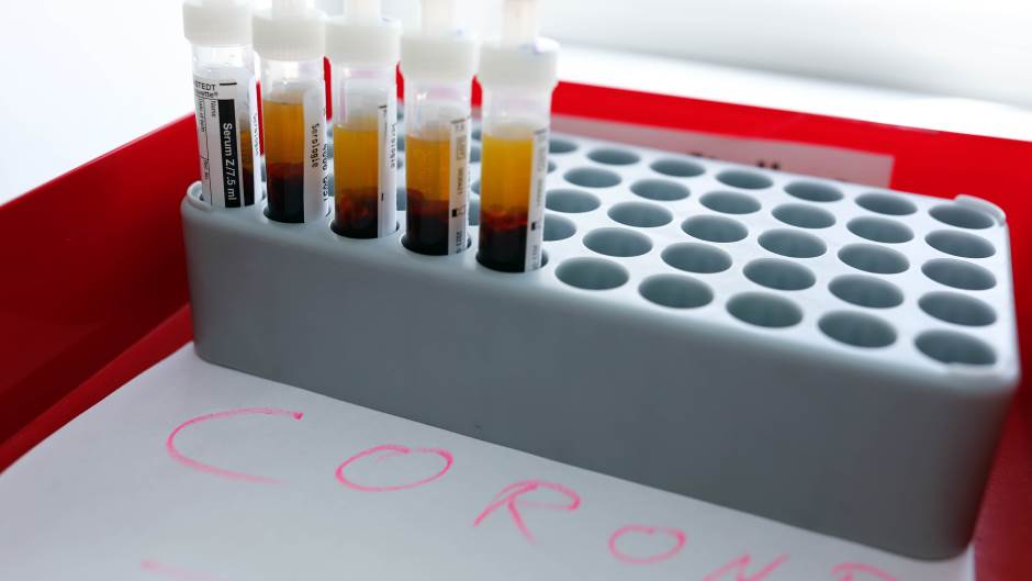2020-03-26t133543z-1354650475-up1eg3q11rjd4-rtrmadp-3-health-coronavirus-germany-287369.jpeg