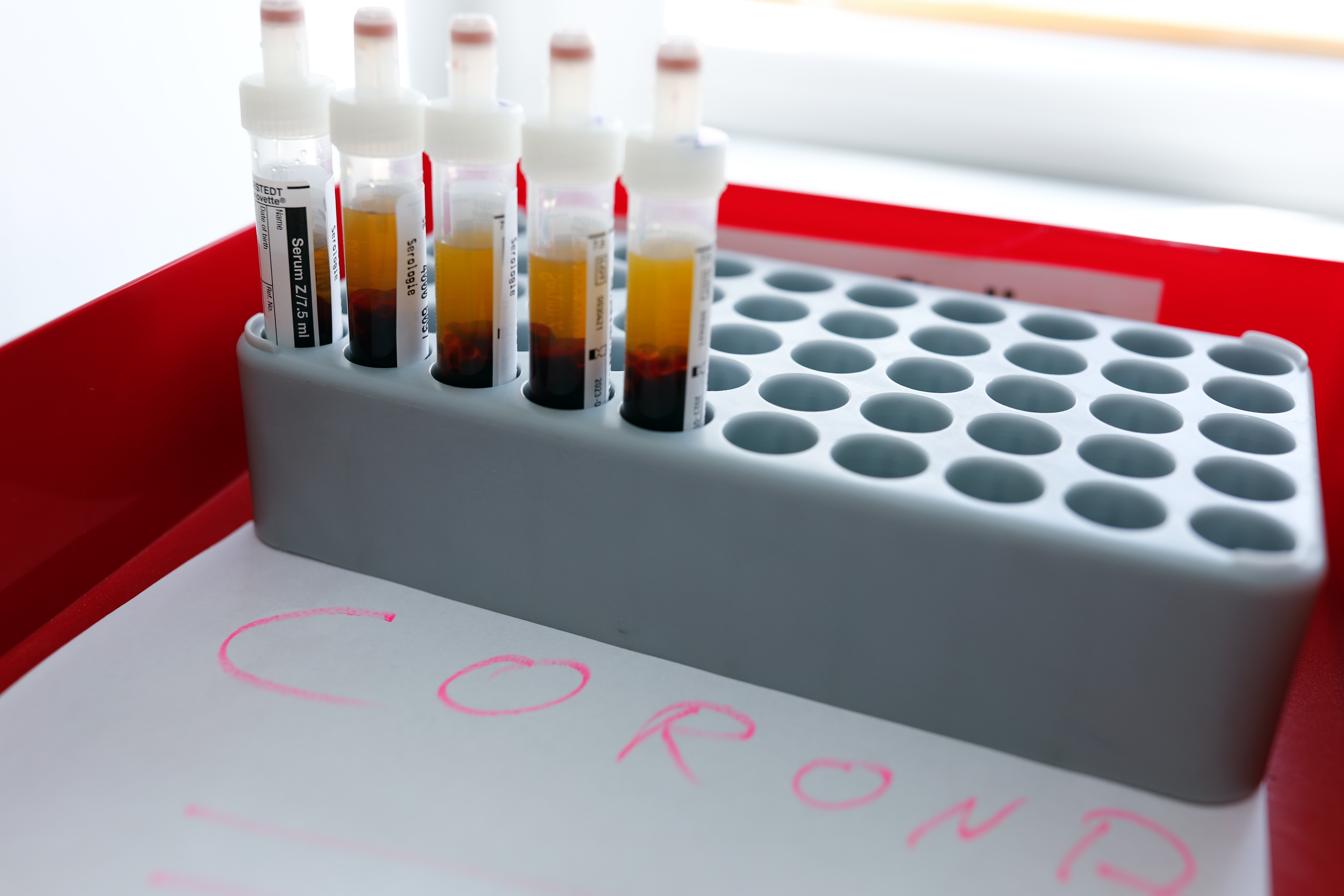 2020-03-26T133543Z_1354650475_UP1EG3Q11RJD4_RTRMADP_3_HEALTH-CORONAVIRUS-GERMANY