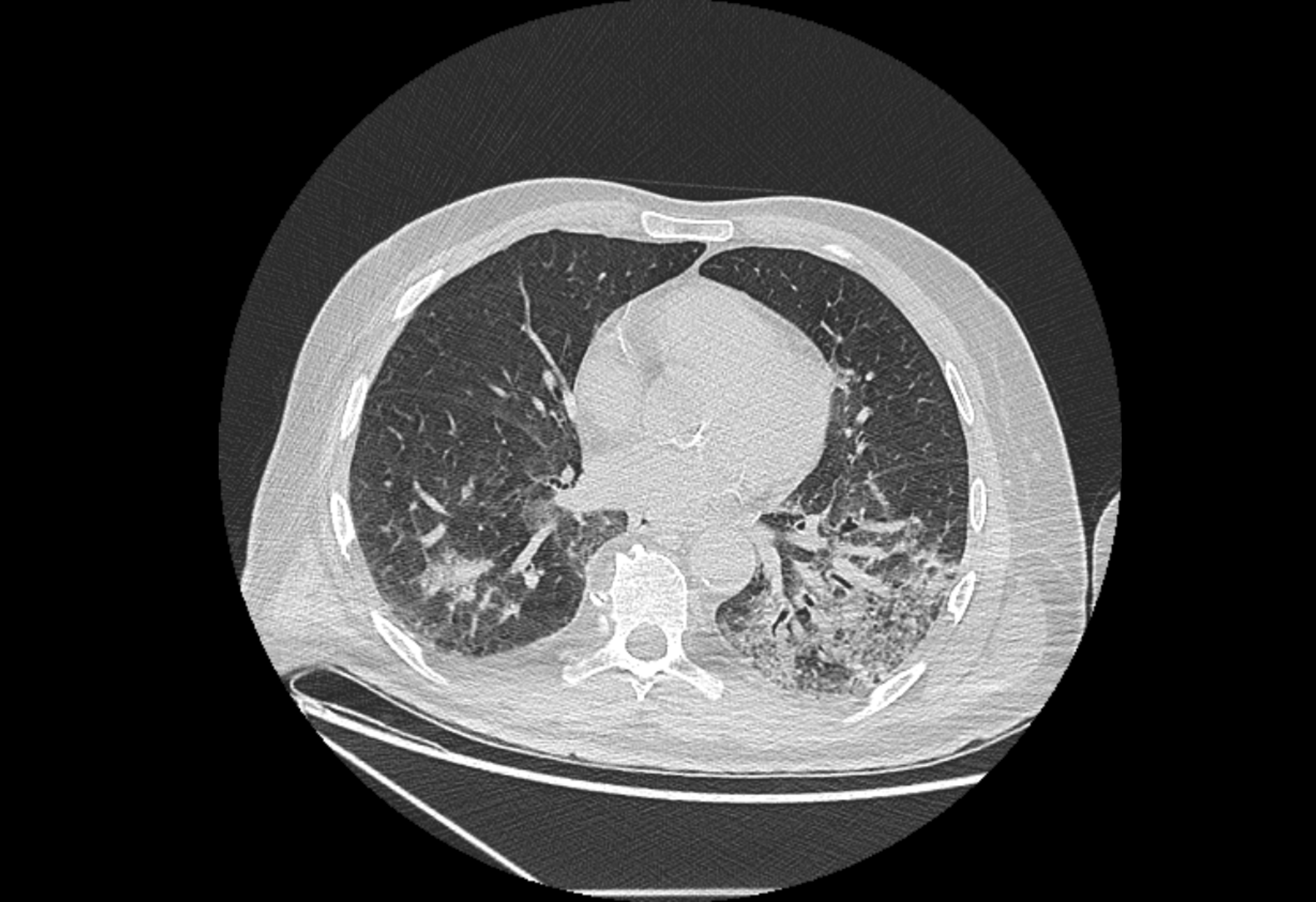 Anadolija (AA)