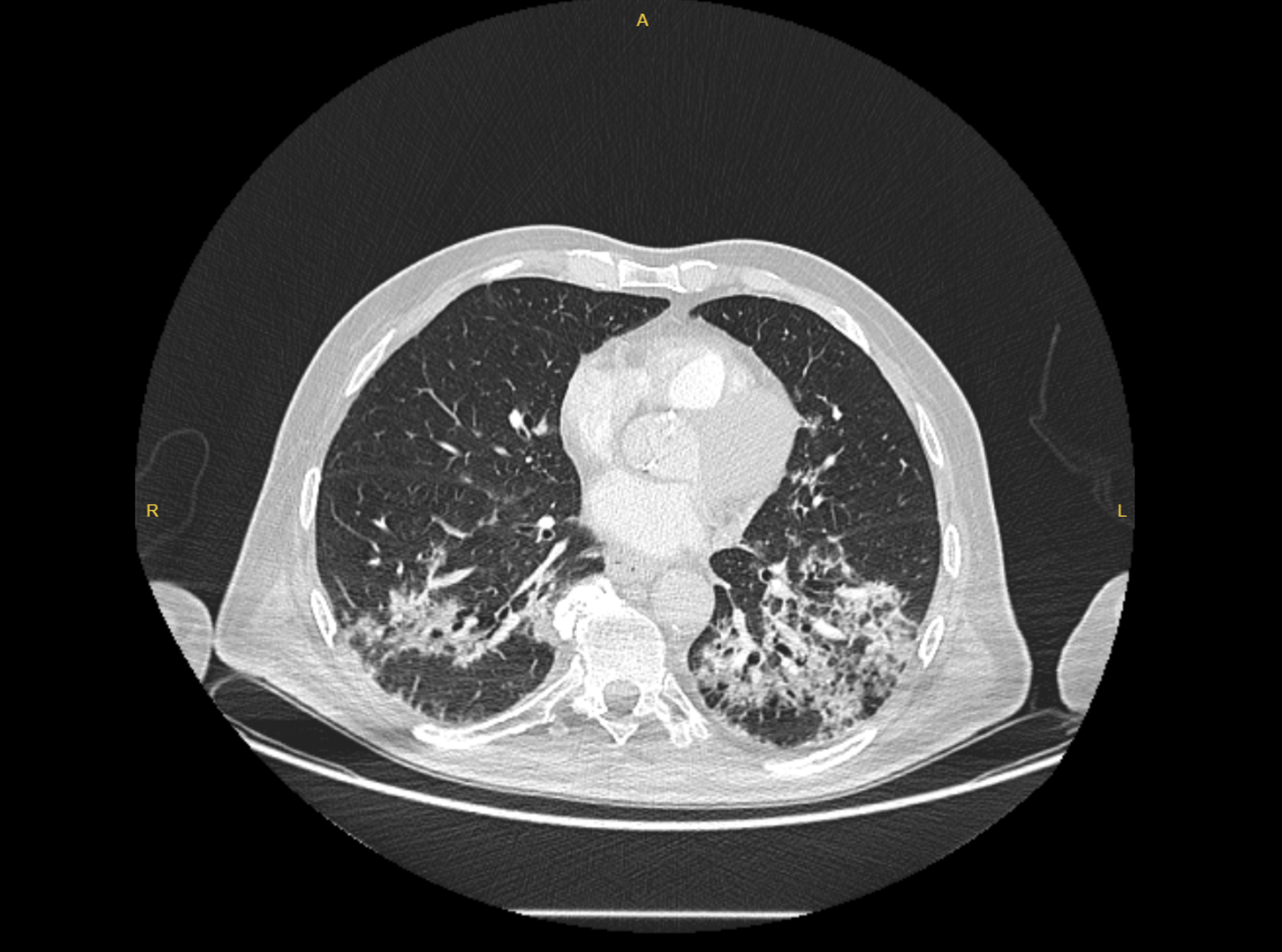 Anadolija (AA)