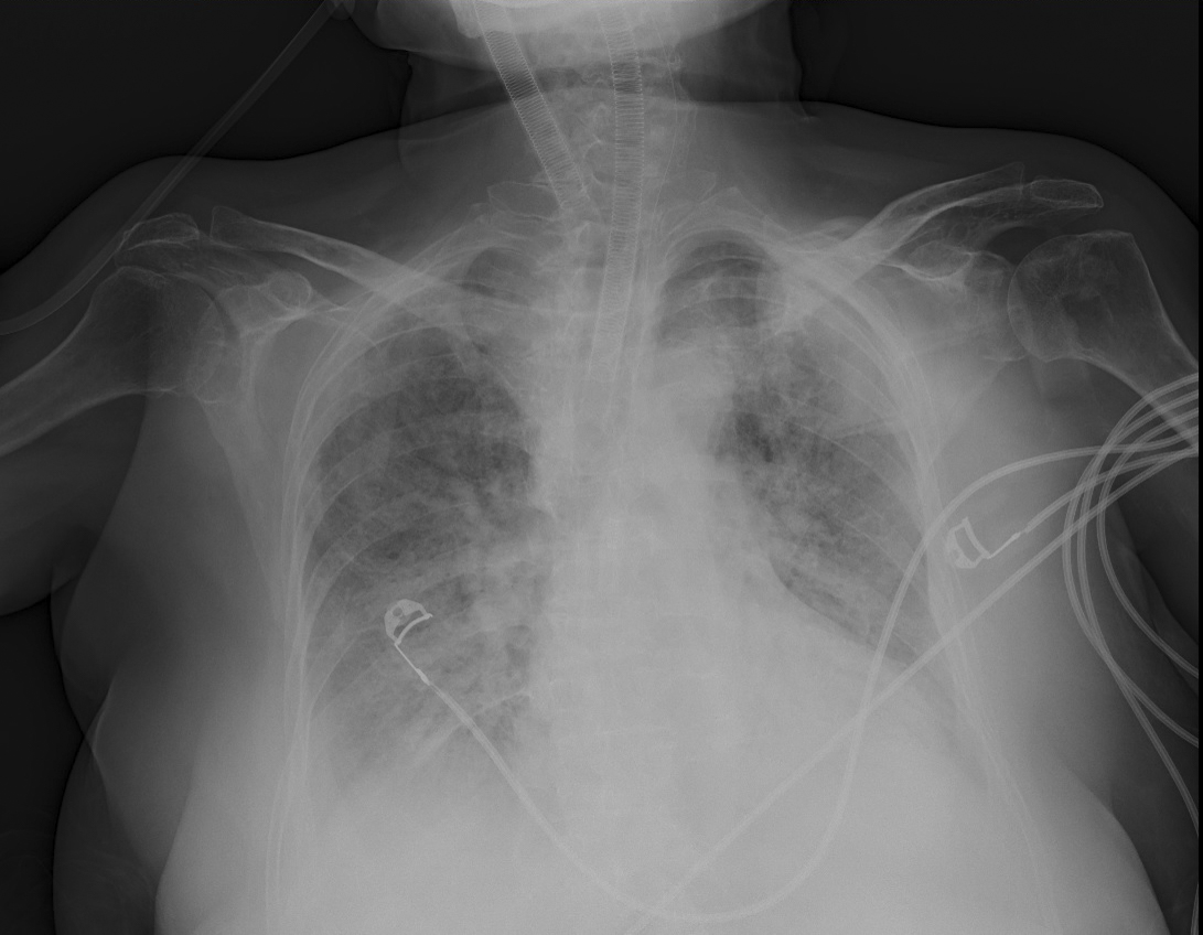 Anadolija (AA)