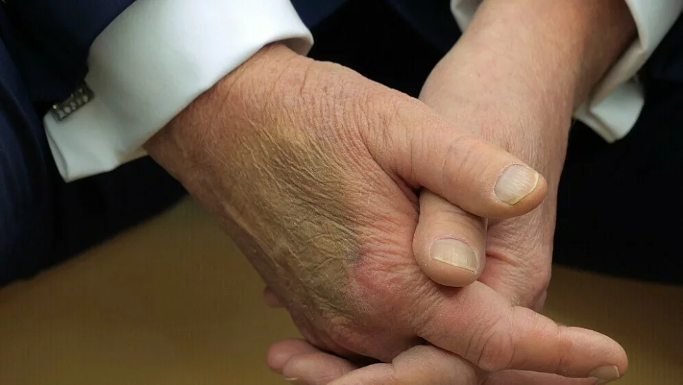 63027059-ruka-donalda-trumpa