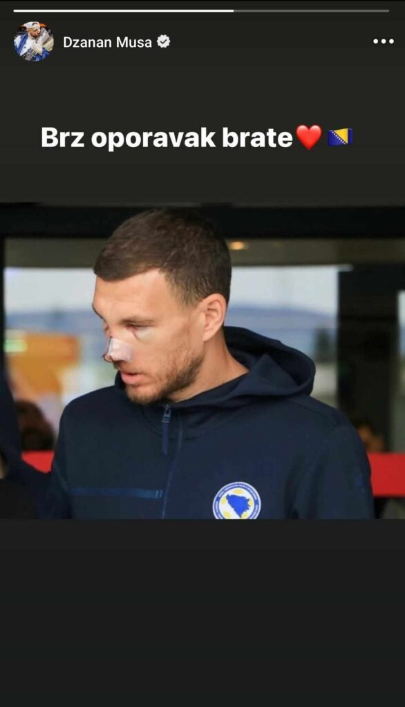 1742665932-dzanan-musa-edin-dzeko-586x1024.jpg